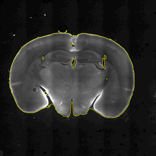 Analysis of fluorescent intensity in brain slices