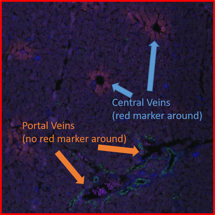 Analysis of Bile ducts around Portal veins in tissue sections
