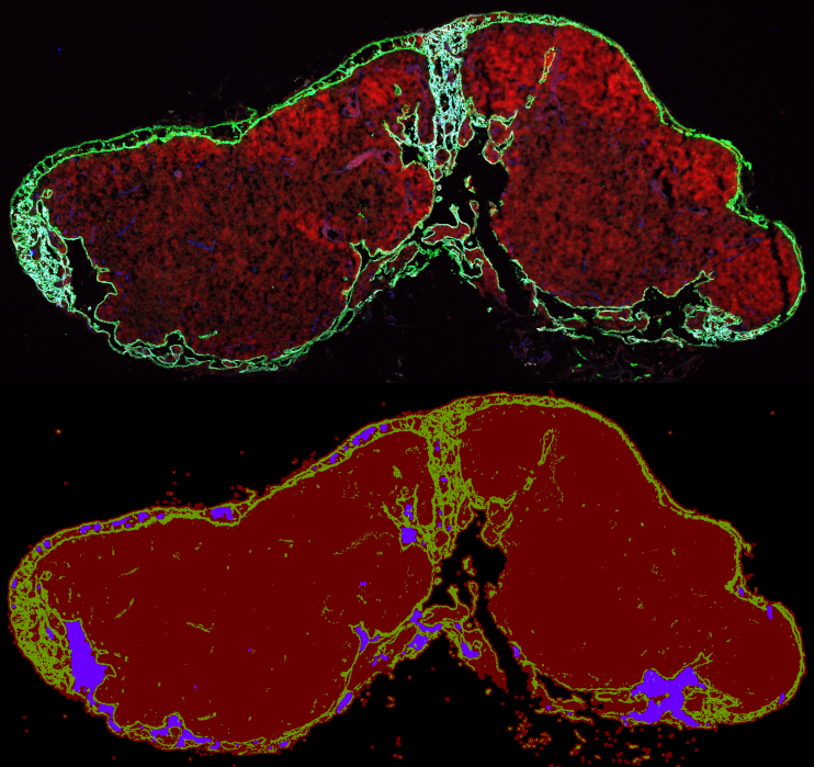 Quantification of vessel and vessel lumen area in tissue sections