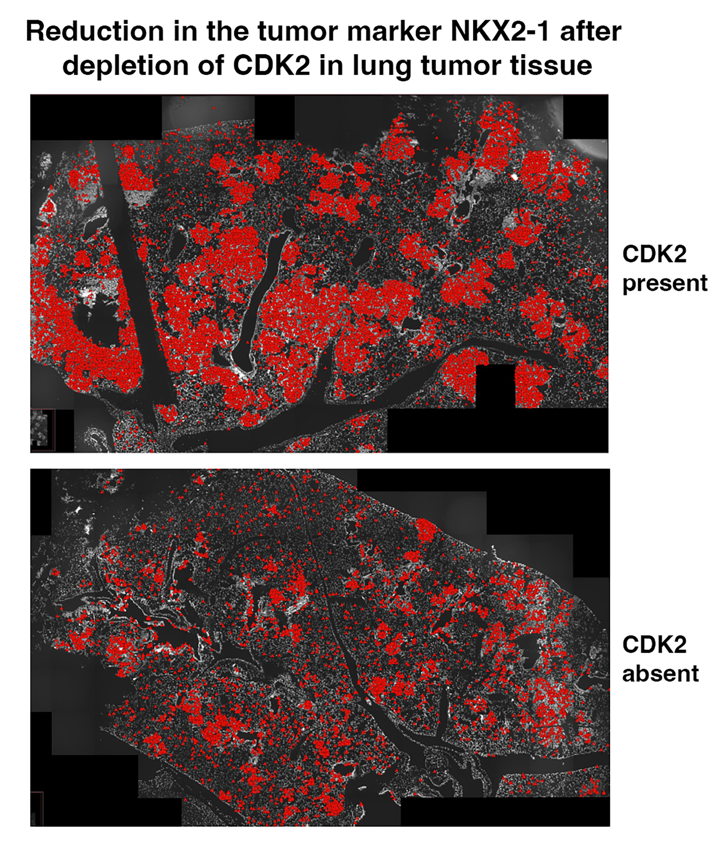 TissUUmaps analysis of ISS data in mouse lung tumors