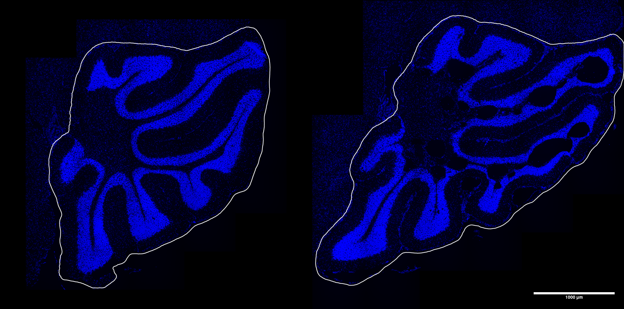 DL segmentation for immunofluorescent imaging of mouse brains
