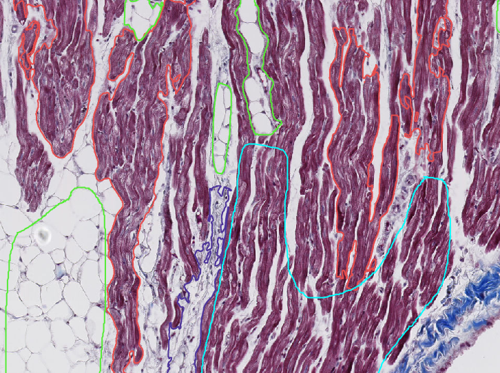 Pathological characterization of cardiac tissue samples from dogs in various stages of myxomatous mitral valve disease or dilated cardiomyopathy