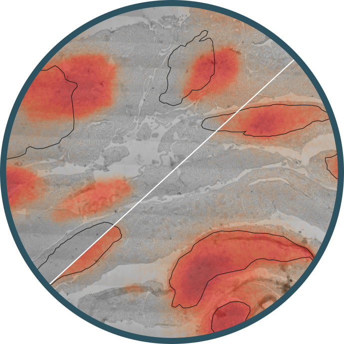 Ultrastructural protein mapping through Correlation of Light and Electron Microscopy