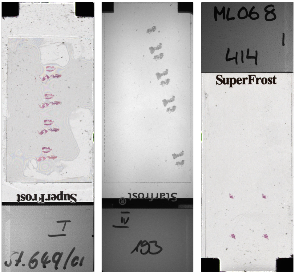 LLM-Accelerated Automated Handwritten Text Extraction from Microscopy Slides