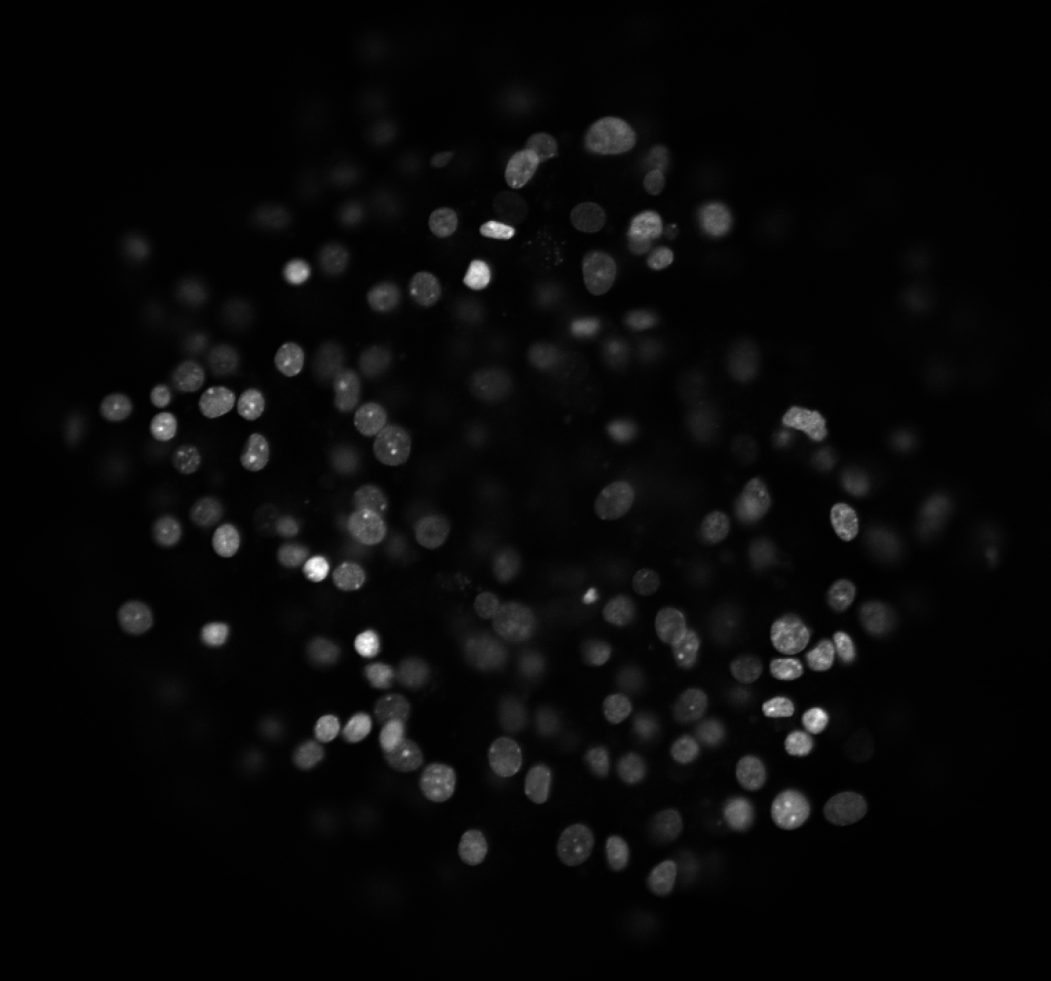 Amyloid Formation Under Stress Conditions in Pancreatic Islets