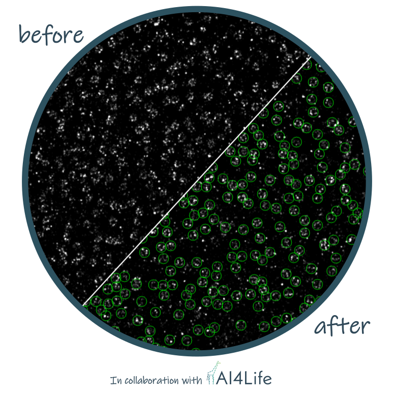 Detection of Nuclear Pore Complexes by DNA PAINT